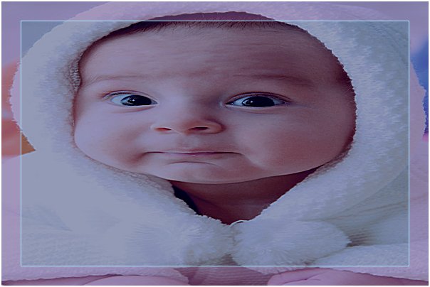 Bebeklerde Gaz Sancısı Nasıl Anlaşılır